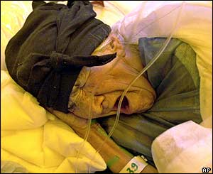 Ozra Momenabadi, 80, takes a rest at the French Field Medical Surgery Hospital, in Bam after five days in the rubble
