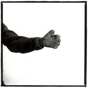 Mutemwa Leprosy Settlement (Photograph by Simon Roberts)