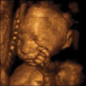 22 weeks gestation, 21 cm from crown to rump.