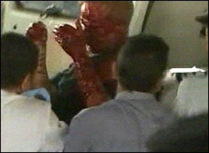 A man, covered with blood, is taken away by ambulance from the scene of the blast in Cairo.