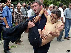 Man carries wounded boy away from siege 