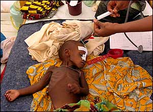 Child receiving drip