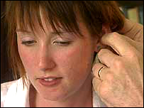 Heidi King is fitted with SpeechEasy device