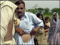 فائل فوٹو: گردے کا ایک ڈونر