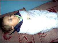 په ماشومانو کې د اېډز ناروغۍ