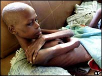 HIV virüsü taşıyan Afrikalı bir kadın