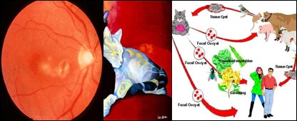 توکسوپلاسموزس