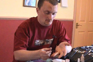 David shows us what a wound would look like if you got your ring caught in a door