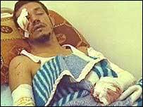 Policial iraquiano ferido