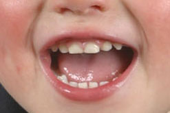 Image: child speaking