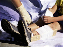 شکستگی استخوان پا