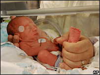 जुड़वाँ बच्चे