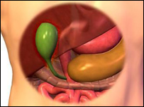 د تريخي تيږې