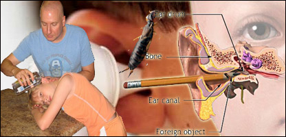 عفونت پرده گوش