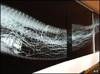 अजगर का एक्सरे