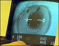 Imagem computadorizada do olho humano