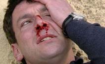 Billy with bloody nose