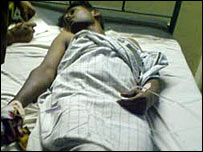 Suspect in the hospital