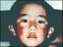 گدهون چوئیکی ناییما، 