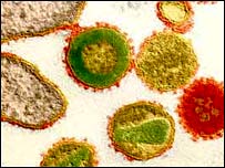 ایچ۔آئی۔وی وائرس