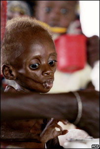 Criança nigerina mal-nutrida