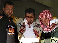 Saldırıda yaralanan bir Iraklı