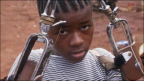 Child amputee in Sierra Leone 