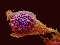 Célula do câncer da próstata