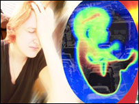 اميدواري اودوينې لوړفشار