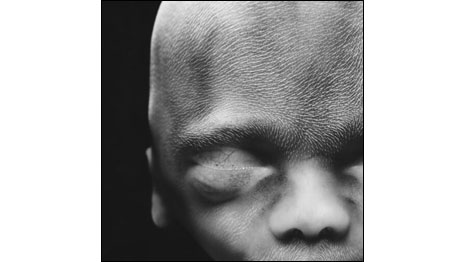 20 semanas (Fotos: Lennart Nilsson)