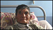 Paciente con Leishmaniasis del Hospital Regional de Cuzco