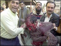 चरमपंथी हमले में घायल एक आदमी