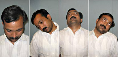 ग्रीवा संचालन की मुद्रा