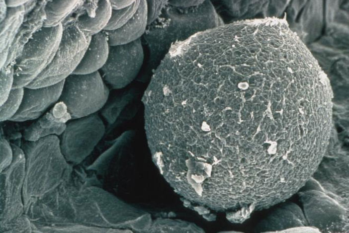 Egg in Fallopian Tube