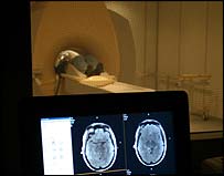 Exames de ressonância magnética