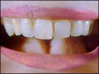 Staffordshire voices