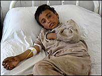 د بهرنيو ځواکونو په عملياتو کې يو ټپي شوى افغان ماشوم (ارشيف)