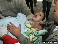 Mulher ferida em Gaza