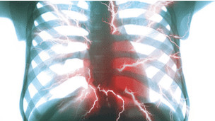 ضغوط العمل مضرة بالقلب