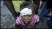 An child injured in Haiti earthquake