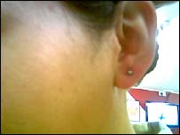 د غوږونو درد