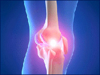  صحت وزندگی: درد زانو