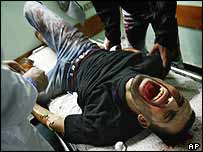 Zraněný Palestinec