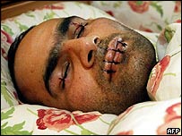 Protesto de refugiado