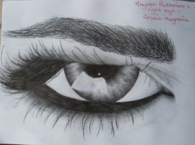 Hayden Pattinere's eye