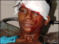 Nhiều người bị thương 