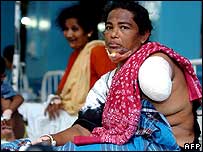 زن مجروح سريلانکايی