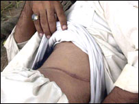 گردہ فروخت کرنے والا ایک شخص