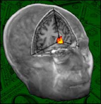 Bronca ativa área do cérebro ligada à diversão