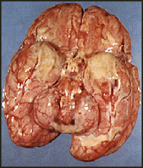 مننجيت يا پوش مغز